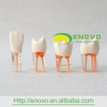 EN-N8 Differing grau de curvatura dentro Root Canals Transparente bloco S4